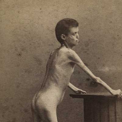 DOMINIQUE CASTAGNA – The Living Mummy