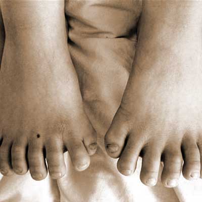 POLYDACTLY MARVELS