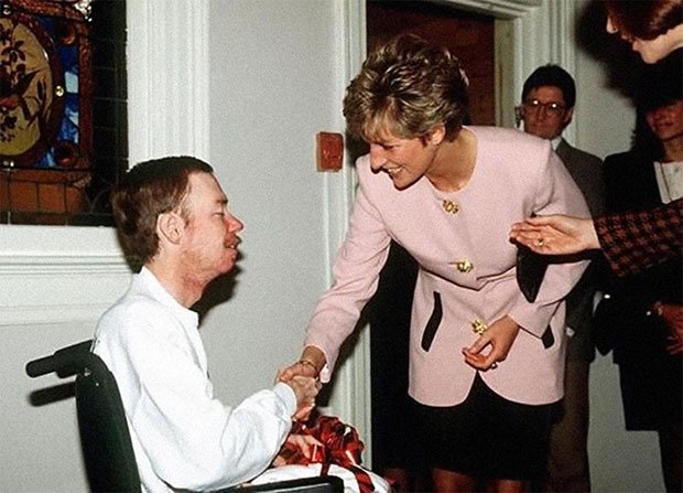 14. AIDS patient