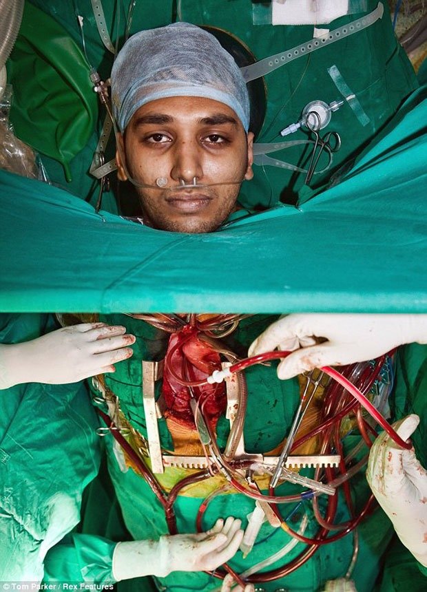 19. Open Heart Surgery