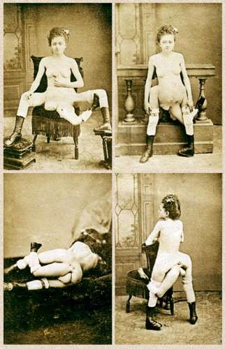 Blanche Dumas freak
