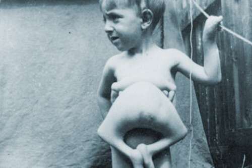 LEN AND ERNIE parasitic twin