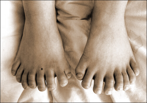 POLYDACTLY MARVELS